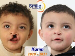 Karim's Healthy Smile