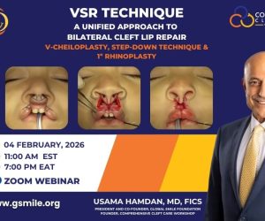 VSR Technique Webinar with Dr. Usama S. Hamdan, MD, FICS